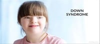 How does Down Syndrome Affect Children?